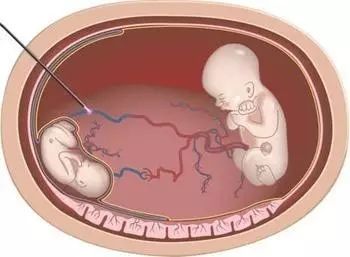 佛罗里达乐园 视频海报