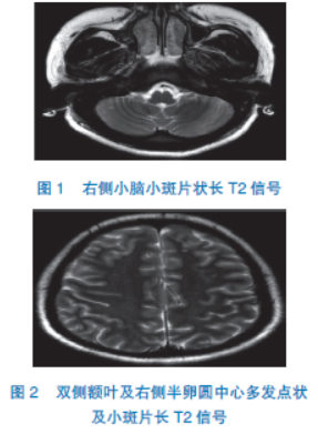 兄弟会 视频缩略图