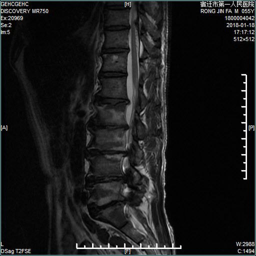 冷面天使 视频缩略图